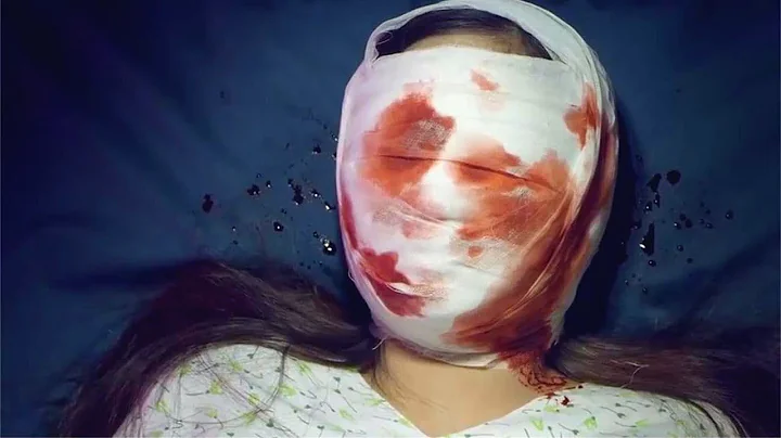 恐怖短片《人形》，女孩疯狂沉迷于整容，最终死在了手术台上